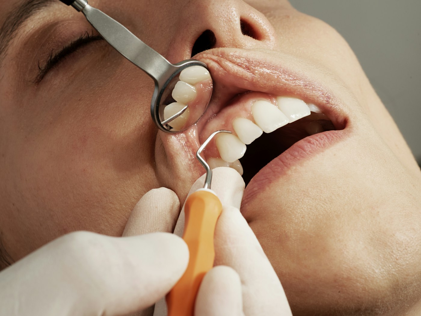 Stock photograph illustrating a dental examination